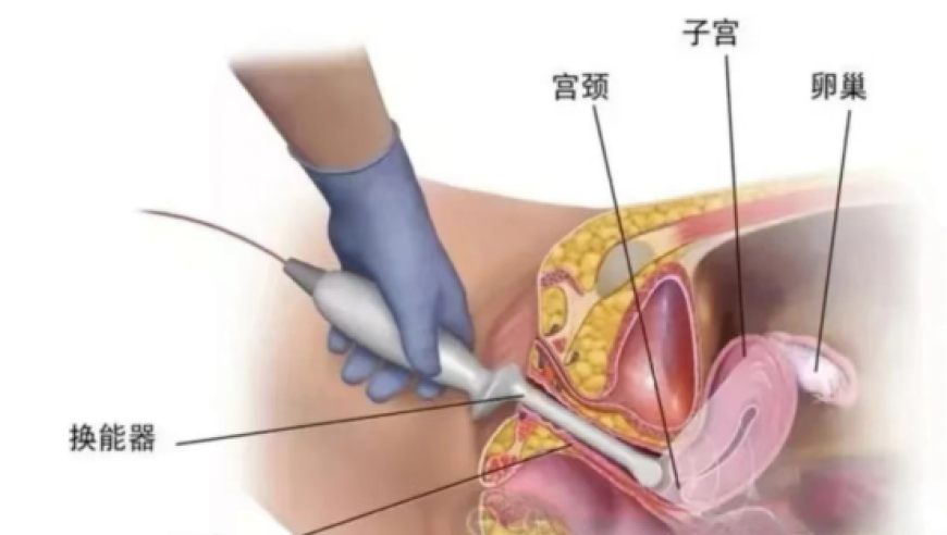 宝马行驶中突发无电滑行 车主发声,管家婆2025正版资料大全下载,最新答案解释落实_极速版V6.11